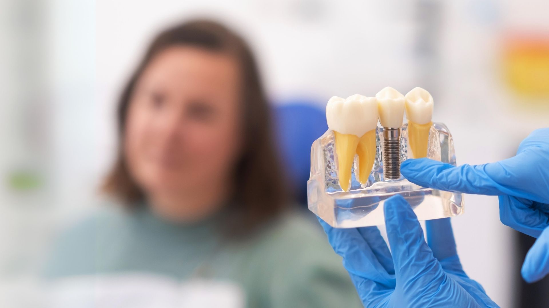 Modelo de implante dentário apresentado durante uma consulta